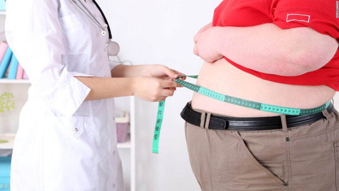 Doctor measuring Obese male